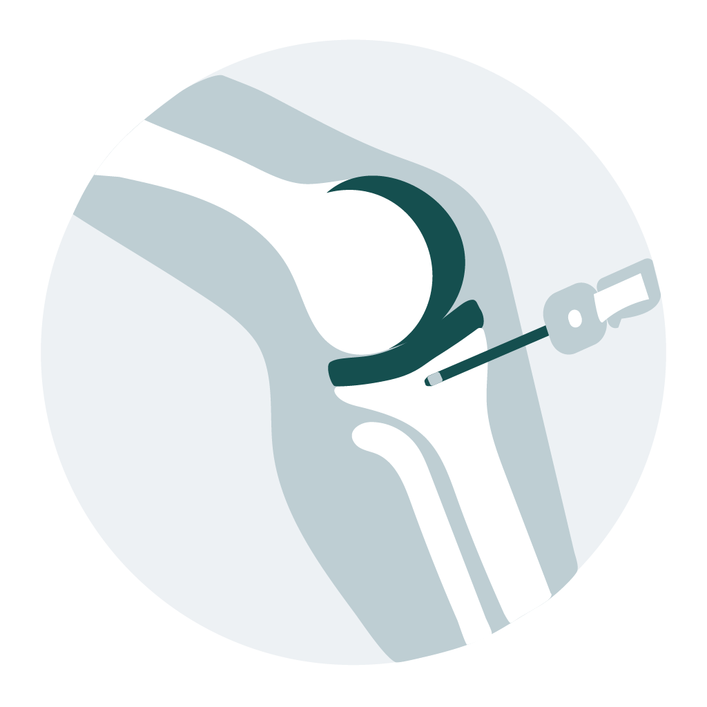 Arthroscopy icon
