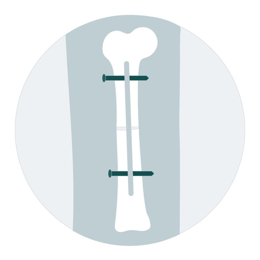 Fracture & trauma icon